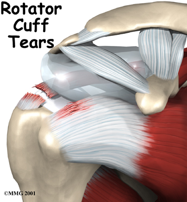 shoulder rotator cuff intro01